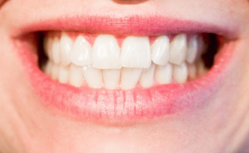 Aktualna technika używana w salonach stomatologii estetycznej może spowodować, że odbierzemy ładny uśmiech.